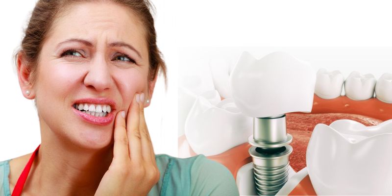 Чи боляче ставити імплант і як проходить імплантація зуба
